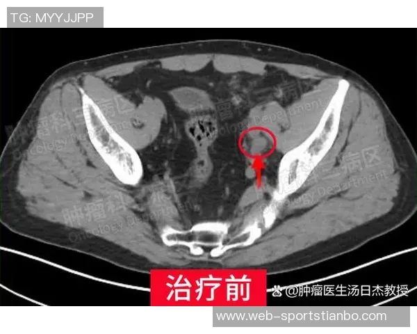 埃奇库姆小腿恢复良好场均144分展现出色状态